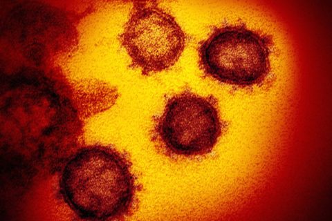 コロナウイルスはなぜ怖いのか
